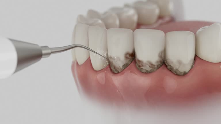 Trusted Dental Implants service in Clifton, TX - Dentist Open Now